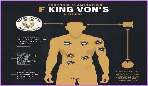 Discover The Shocking Truth: King Von's Autopsy Photos Revealed
